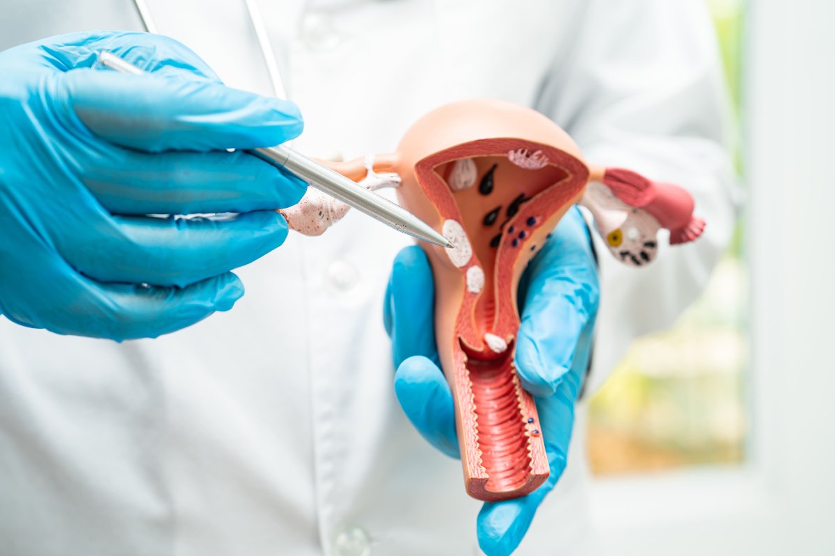 Prosedur histeroskopi di Ciputra IVF